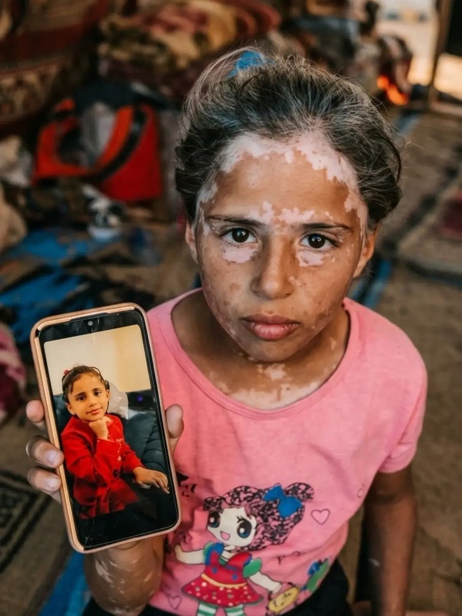 PalPress24's tweet photo. This is what fear has done to our children in Gaza as a result of the genocidal war. https://t.co/LYRfr5u218