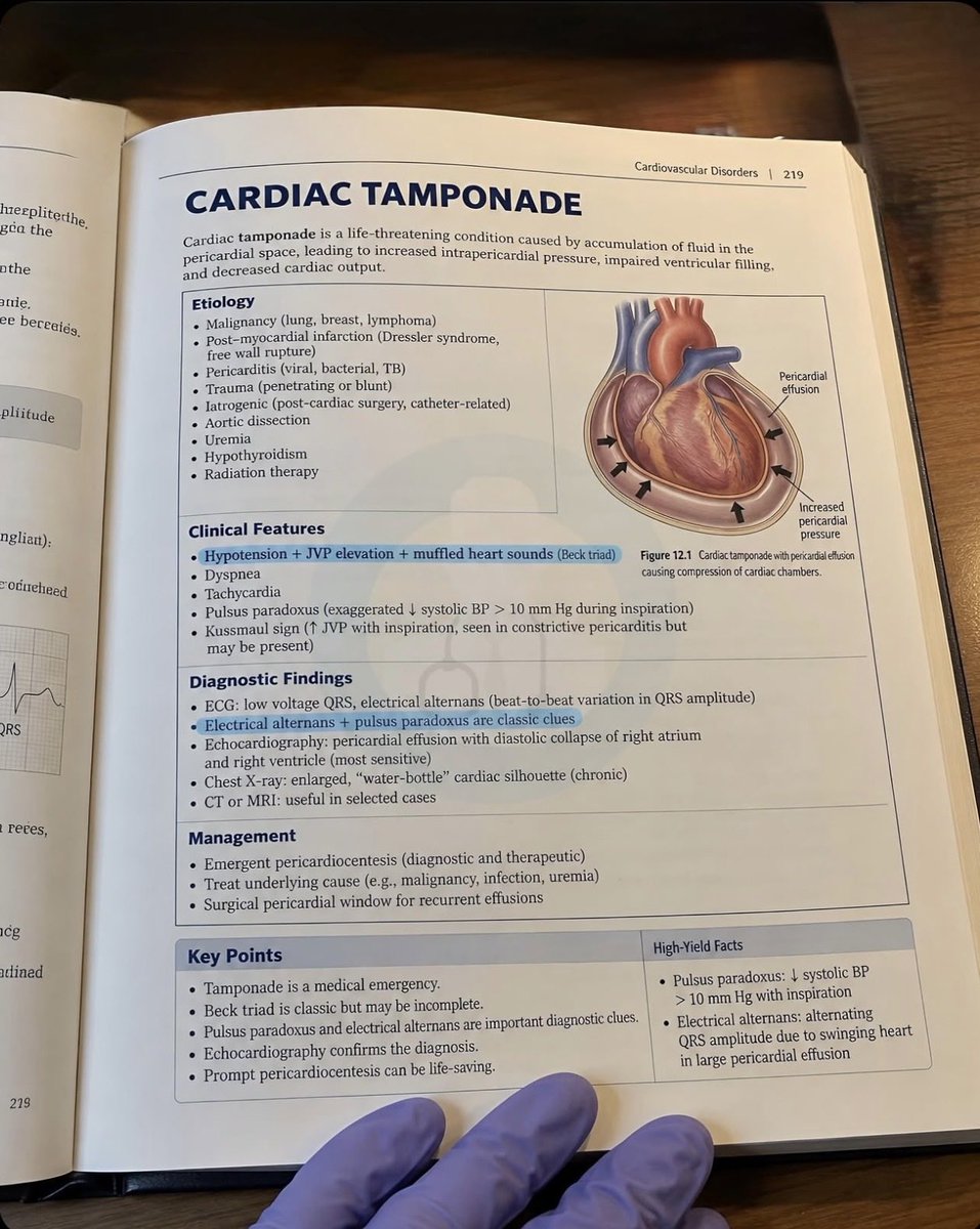 abdulhamid_199's tweet photo. صورة تختصر لك 
اهم المواضيع في الطب ( Cardiac Tamonade) 

كيف تشخص وتعالجه

جدا مفيد 
احفظه عندك https://t.co/RO6BNh3BPy