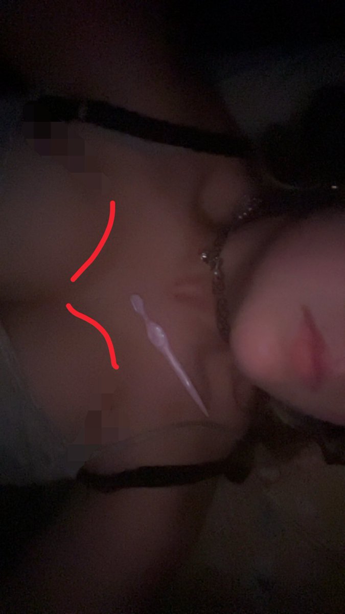 evatsze's tweet photo. i want scars here so badly https://t.co/tYuvtsnjxy