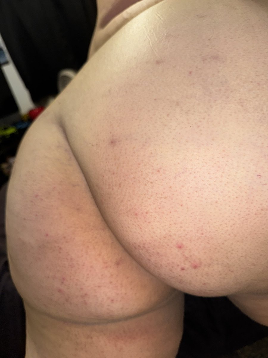 magicalpuss69's tweet photo. The ass &amp; the pussy! 

#horny #ass #dickmedown #wlw https://t.co/IQlzQOHH5K