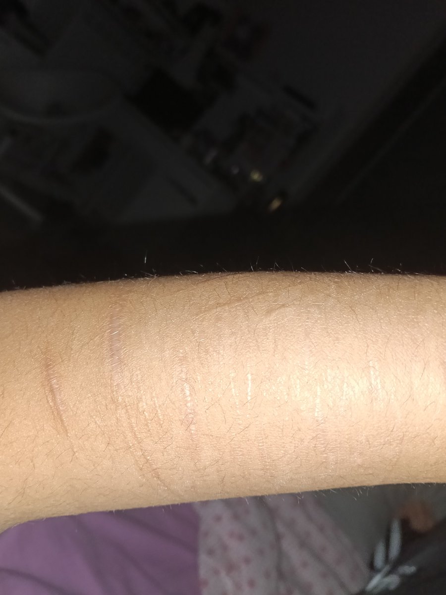 sliteyeballs's tweet photo. scars check except they ain't that visible https://t.co/yQVmQV8IbX