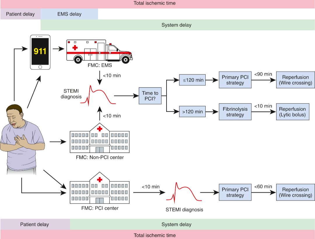 TrackYourHeart's tweet photo. STEMI: Every Minute of Ischemia Matters

In STEMI, the clock starts before the patient reaches the cath lab.

Total ischemic time includes:
Patient delay + EMS/system delay = total ischemic time

The goal is not simply door-to-balloon.
It is to minimize the entire interval from symptom onset to coronary reperfusion.

The practical decision
Once STEMI is diagnosed, ask:
Can primary PCI be achieved within 120 minutes from diagnosis/FMC?

✅ If yes, the patient should be taken for primary PCI.

❌ If timely PCI cannot be achieved within 120 minutes, fibrinolysis should be considered when appropriate and there are no contraindications, followed by transfer to a PCI-capable centre. The 2023 ESC ACS guideline continues to use this 120-minute threshold. 

For systems capable of rapid primary PCI, contemporary U.S. guidance emphasizes even faster targets: the 2025 ACC/AHA ACS guideline recommends a FMC-to-first-device goal of ≤90 minutes for patients transported directly to a PCI-capable hospital, while ≤120 minutes remains an important threshold when longer transfer is involved. 

Why this matters
⚪ Every unnecessary delay means prolonged myocardial ischemia.

⚪ The 2025 ACC/AHA guideline notes that for patients undergoing primary PCI, each additional 30 minutes of treatment delay has been associated with an increase in relative 1-year mortality risk. 

Source: Ibanez B, et al. 2017 ESC Guidelines for the management of acute myocardial infarction in patients presenting with ST-segment elevation. Eur Heart J. 2018;39:119–177.