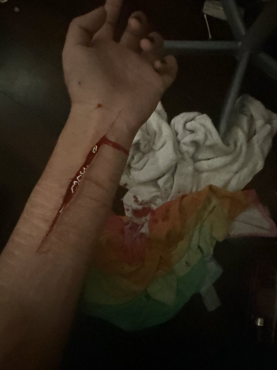 xC4ndY_H34RtXx's tweet photo. REPOST bc it got taken down.. and I wanna see it go viral again 
SFX MAKEUP not a real injury im just good at makeup 100% 
#shrtwt #healing🥺 https://t.co/4i8QWELnvj