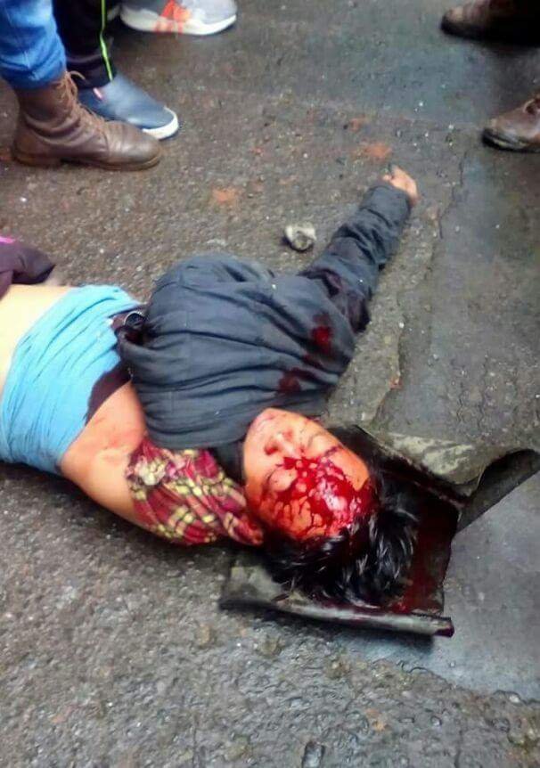 Charminarsleuth's tweet photo. @ArpitChhetri12 @RebelSanyasi @_nirvanapunk Coward babus hai isliye tumlogo ko protest karna padta hai goliyan khana padta hai marna padta hai apne baap bhai khona padta hai coward babus ke daar se  jaise ki ek example -1 gurkha 💩 https://t.co/SYPLeyYpg7