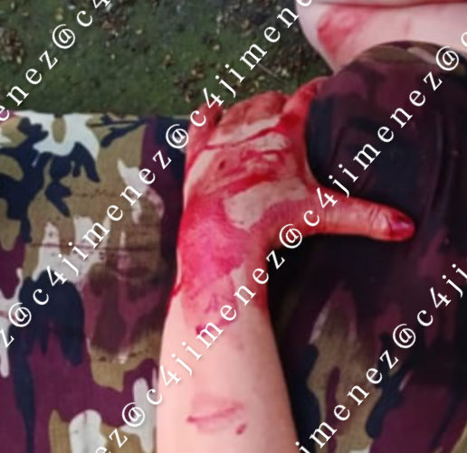 c4jimenez's tweet photo. CUBANA RECLAMA por la POPÓ de un PERRO… y LA APUÑALAN 
Amandamiguel Canelo 
Jonathan García
Sacaron a pasear a su perro, en la Col Popotla @AlcaldiaMHmx 
El can hizo popó afuera de casa de la cubana Mayelín Peña, y ella salió a reclamar.
Discutieron.
Amandamiguel sacó un cuchillo y se lo clavó en el pecho.
Agentes de @SSC_CDMX Sector Tacuba los detuvieron.
Acabaron en @FiscaliaCDMX; 
Mayelín en el hospital.