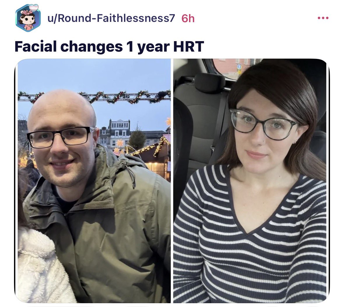 ToastyMosty6969's tweet photo. Because apparently slapping a wig on a head can make men turn into women 😂🤡

#mentalillness https://t.co/bldYE8Tv0w