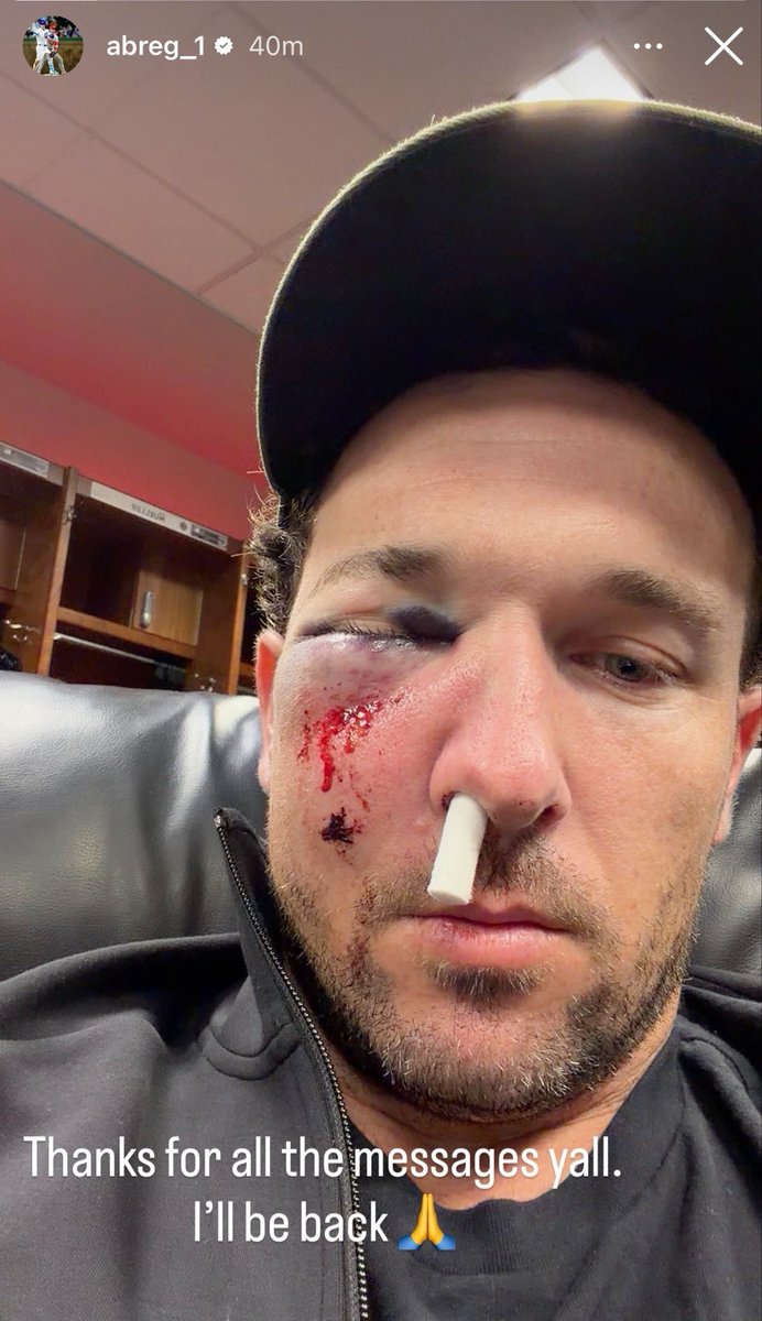 michaelschwab13's tweet photo. Alex Bregman was hit in the face with a line drive while he was on deck. He posted that he is OK https://t.co/X9rbJydjGp