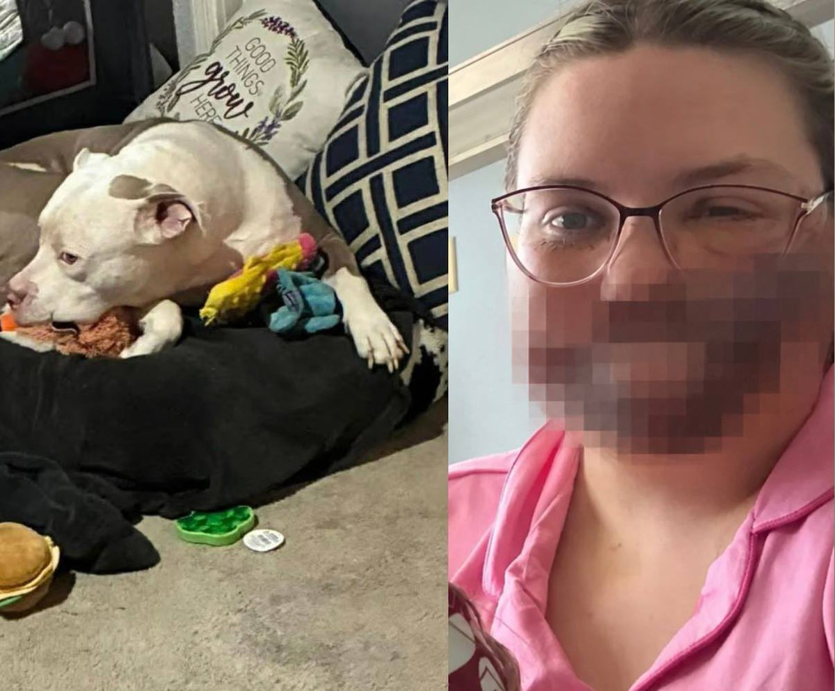 MorbidKnowledge's tweet photo. On March 2, 2026, 25-year-old Karma Davis suffered a seizure in her Illinois home and woke to discover her family dog had torn away much of her face.

Davis, who has epilepsy, believes forgetting her medication that day triggered the seizure.

While she was unconscious, the family’s pit bull, Fayzo, mauled her.

Both of her lips were gone. 

Much of her left cheek and the bottom of her nose had been torn away, her left ear was badly disfigured, and her right ear was partially ripped off.

When Davis regained consciousness, she found her iPad and video-called her fiancé, Trenton.

That was when she realised how badly she had been injured.

“Fayzo ate my face,” she remembered repeating. “I look like a skeleton. My lips are gone.”

Davis was rushed to hospital and placed in a medically induced coma for around two and a half days while surgeons began reconstructing her face.

Doctors managed to reattach much of her right ear, but she has required multiple surgeries, skin grafts and a feeding tube while facing a long reconstruction process.

The family had rescued Fayzo from an abusive home around four years earlier, and Davis said the dog had never previously shown aggression.

Animal control euthanized him after the attack.
