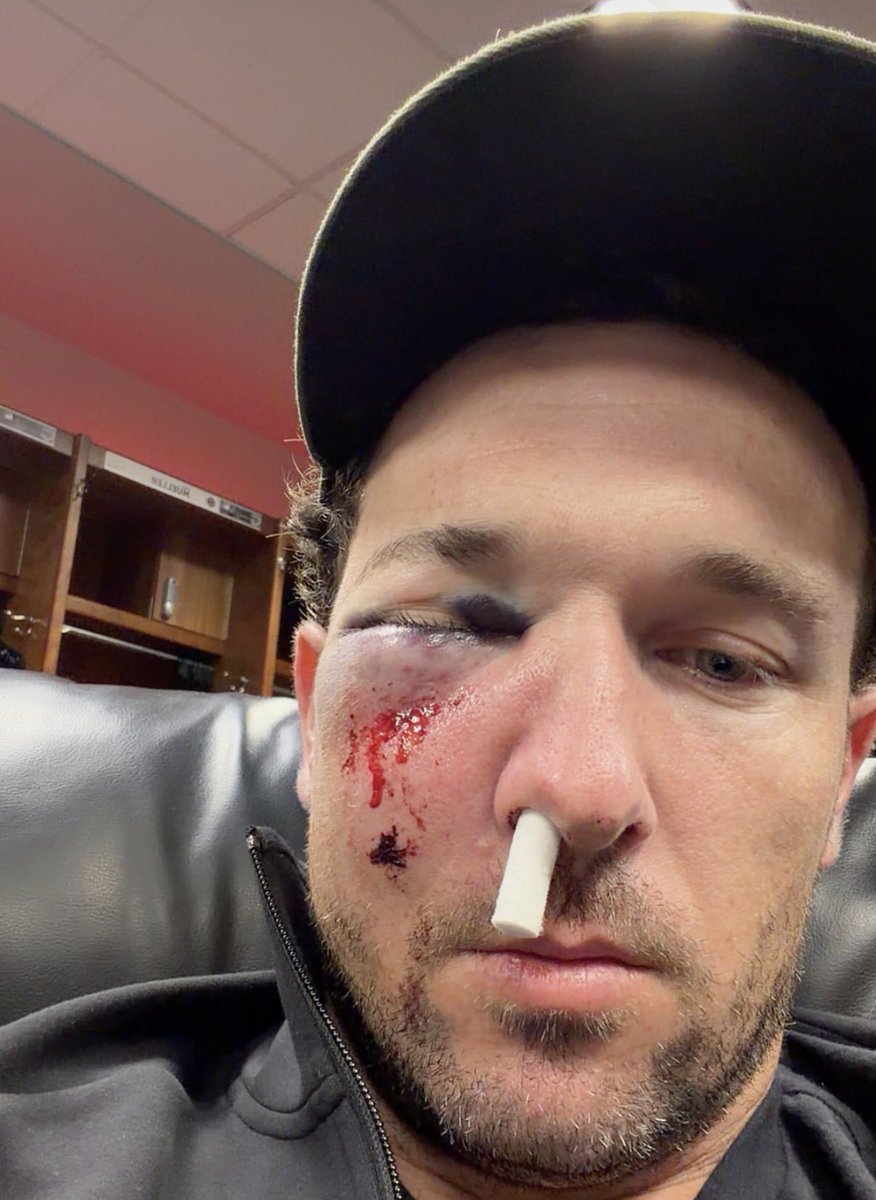 BLima790's tweet photo. How it feels being an Astros and Texans fan: https://t.co/0y6S78B5TG