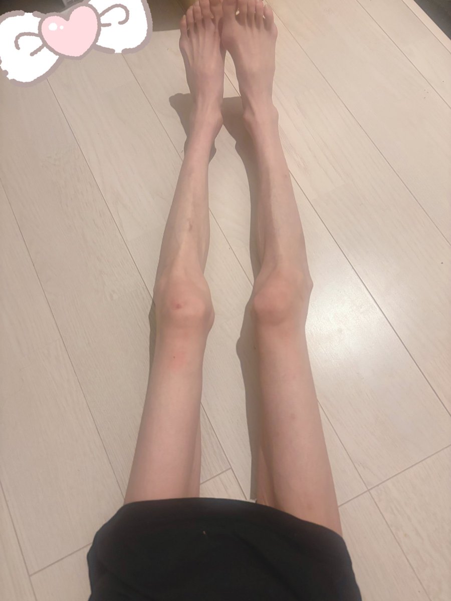 Oimo__ice10's tweet photo. 頭では異常なのは分かっていても心の底で安心感を感じてしまう自分がいてつらい

#edtwt #ed #thinspo #ana #bonespo 
#拒食症 #摂食障害 #摂食障害克服中
#闘病垢さんと繋がりたい https://t.co/h2BdOIAKqB