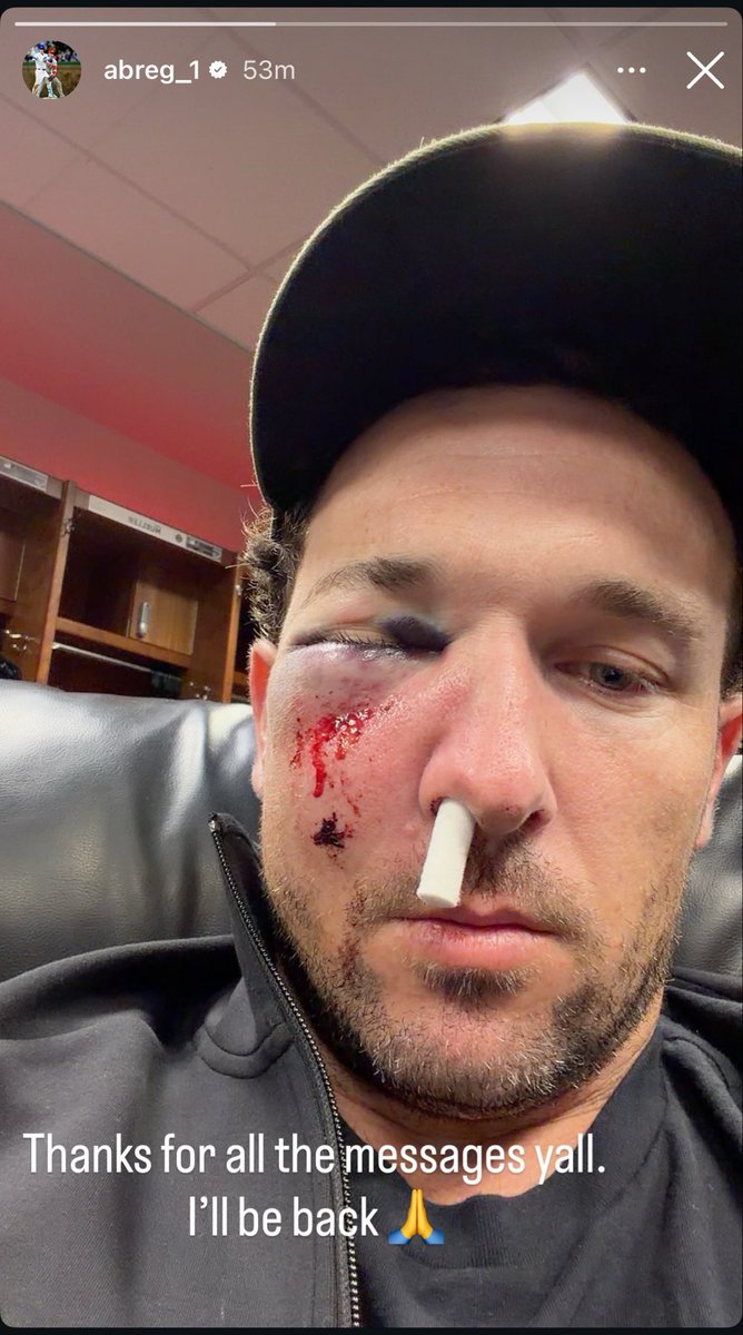 FoulTerritoryTV's tweet photo. Alex Bregman shares a message with fans after taking a foul ball to the face while on deck 🙏 https://t.co/O0rIdgRC8W