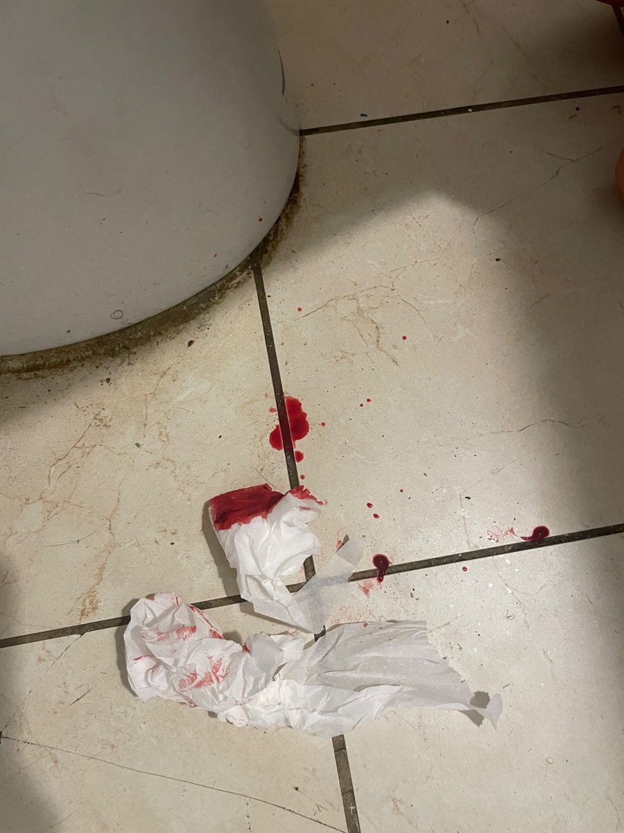 Silly_manzzz's tweet photo. #shedtwt #shtwt #slittwt I felt bored today so I ended up cutting my self before I went to shower https://t.co/zdqmD3MPDh