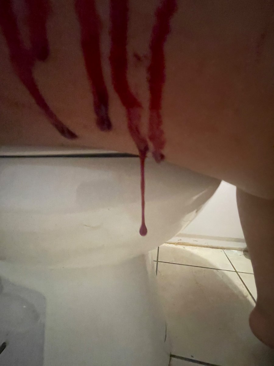 Silly_manzzz's tweet photo. #shedtwt #shtwt #slittwt I felt bored today so I ended up cutting my self before I went to shower https://t.co/zdqmD3MPDh