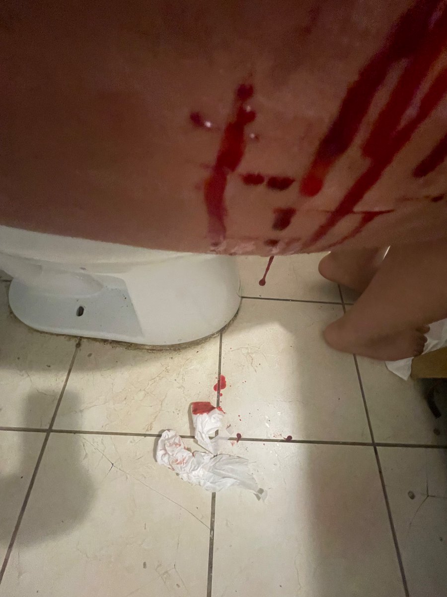 Silly_manzzz's tweet photo. #shedtwt #shtwt #slittwt I felt bored today so I ended up cutting my self before I went to shower https://t.co/zdqmD3MPDh