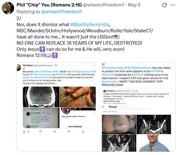 wheeloffreedom1's tweet photo. BIOCHIP TORTURE is so fucking cruel & evil...😣
I am hoping Trump NUKs the entire fucking planet!
#BiochipTerrorists RNM🤣💻mock & shock🛰️6G⚡️
#StJohnAffect #HollywoodDemon controls Trump!
Why should only I have to suffer every min of my life?
EVERYONE TORTURING ME SHOULD👇ALSO https://t.co/HN83UAQOFZ