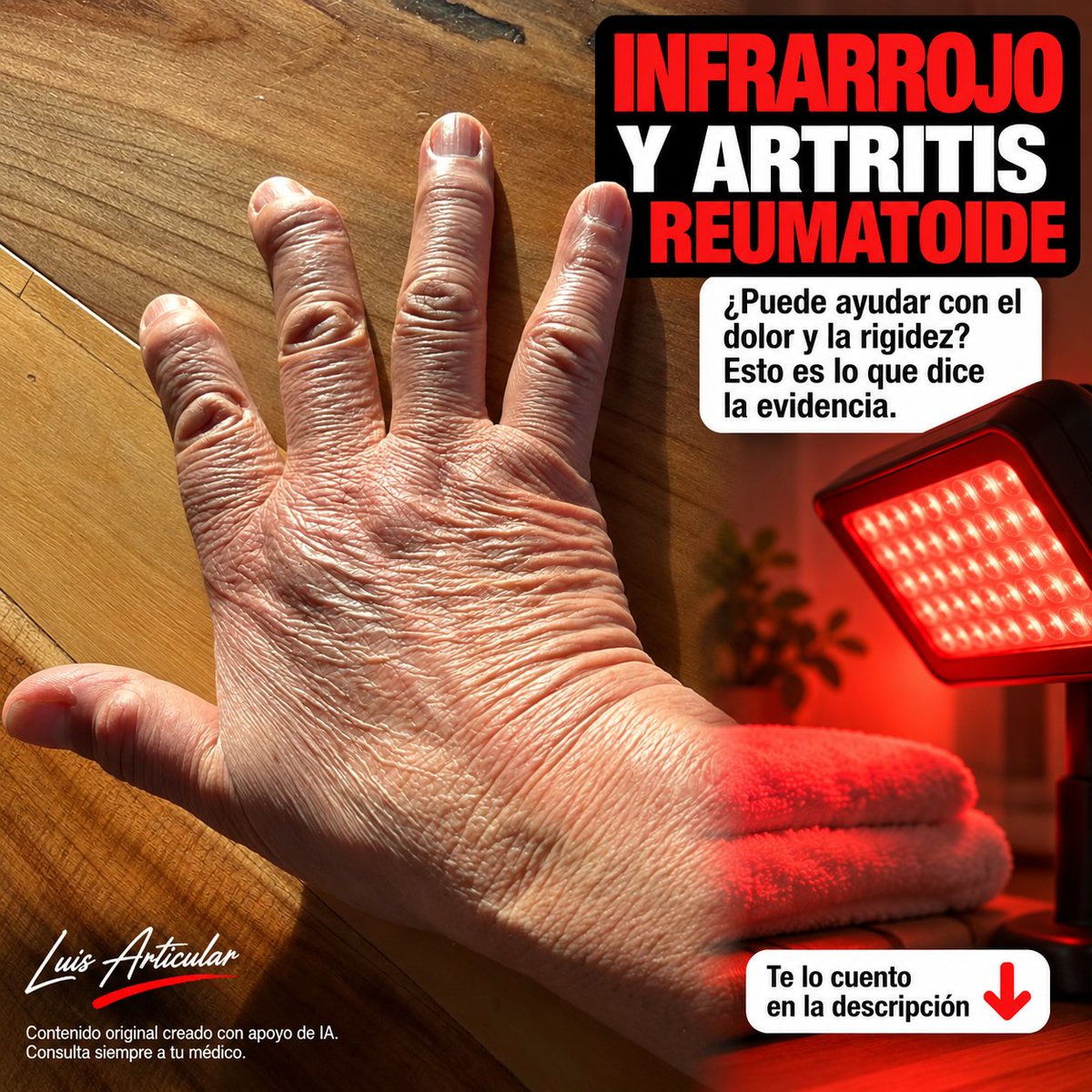 luisarticular's tweet photo. 🔦 La luz roja no hace magia
ㅤ
Pero eso tampoco significa que no tenga nada interesante detrás.
ㅤ
Si tienes artritis reumatoide probablemente hayas visto alguna vez uno de estos dispositivos:
ㅤ
Paneles rojos.
ㅤ
Lámparas infrarrojas.
ㅤ
Saunas infrarrojos.
ㅤ
Equipos de fisioterapia.
ㅤ
Láser de baja intensidad.
ㅤ
Y alrededor de todos ellos aparecen palabras enormes:
ㅤ
“Inflamación”.
ㅤ
“Regeneración”.
ㅤ
“Mitocondrias”.
ㅤ
“Dolor”.
ㅤ
“Recuperación”.
ㅤ
El problema comienza cuando tecnologías diferentes terminan metidas dentro de la misma bolsa.
ㅤ
Porque “infrarrojo” puede significar cosas bastante distintas.
ㅤ
Una lámpara que fundamentalmente calienta la piel no es necesariamente equivalente a un dispositivo utilizado para fotobiomodulación.
ㅤ
Y un panel doméstico tampoco reproduce automáticamente el protocolo utilizado en un ensayo clínico.
ㅤ
Entonces empecemos por el principio.
ㅤ
🔴 ¿QUÉ ES LA FOTOBIOMODULACIÓN?
ㅤ
Es el uso de determinadas longitudes de onda de luz, principalmente dentro del espectro rojo e infrarrojo cercano, con el objetivo de producir respuestas biológicas en los tejidos.
ㅤ
Parte de esa energía puede penetrar y ser absorbida por componentes celulares.
ㅤ
A partir de ahí se investigan modificaciones en diferentes procesos relacionados con señalización celular, circulación local, inflamación y percepción del dolor.
ㅤ
Suena sofisticado.
ㅤ
Y lo es.
ㅤ
Pero “existe un mecanismo interesante” nunca debería traducirse automáticamente como “cura una enfermedad”.
ㅤ
Ese salto es precisamente el que tenemos que evitar.
ㅤ
🤲 ¿QUÉ PASA EN ARTRITIS REUMATOIDE?
ㅤ
Se han estudiado modalidades como el láser de baja intensidad y otras formas de fotobiomodulación.
ㅤ
Algunos trabajos han encontrado mejoras en determinados síntomas, entre ellos dolor y rigidez.
ㅤ
Eso abre una posibilidad interesante como terapia complementaria.
ㅤ
Pero los resultados no significan que hayamos descubierto una manera de apagar la artritis reumatoide utilizando una lámpara.
ㅤ
La enfermedad sigue siendo autoinmune e inflamatoria.
ㅤ
Su control requiere evaluar actividad, síntomas, función y riesgo de daño articular.
ㅤ
Aquí aparece una frase que quiero que recuerdes:
ㅤ
MENOS DOLOR NO SIEMPRE SIGNIFICA MENOS ENFERMEDAD.
ㅤ
Parece contradictorio.
ㅤ
Pero no lo es.
ㅤ
Imagina que aplicas calor sobre una articulación rígida.
ㅤ
Después de unos minutos te sientes mejor.
ㅤ
El dedo se mueve con mayor comodidad.
ㅤ
¿Ese cambio es real?
ㅤ
Claro.
ㅤ
¿Demuestra que desapareció el proceso autoinmune?
ㅤ
No.
ㅤ
El alivio sintomático puede ser valioso sin necesidad de convertirlo en una cura.
ㅤ
🔥 ¿ENTONCES EL INFRARROJO SOLO CALIENTA?
ㅤ
Depende del dispositivo.
ㅤ
Aquí está precisamente una de las confusiones.
ㅤ
Algunas fuentes infrarrojas producen un efecto térmico considerable.
ㅤ
En esos casos parte de la experiencia puede estar relacionada con calor.
ㅤ
El calor puede favorecer temporalmente relajación muscular y hacer más cómodo el movimiento cuando predomina la rigidez.
ㅤ
La fotobiomodulación busca efectos que no dependen exclusivamente de calentar el tejido.
ㅤ
Por eso necesitamos saber qué estamos utilizando antes de interpretar los resultados.
ㅤ
💡 AHORA MIRA EL PANEL QUE TE VENDEN POR INTERNET.
ㅤ
Visualmente puede parecer idéntico al de otra marca.
ㅤ
Pero existen variables importantes:
ㅤ
Longitud de onda.
ㅤ
Potencia.
ㅤ
Densidad de energía.
ㅤ
Distancia.
ㅤ
Duración.
ㅤ
Frecuencia de aplicación.
ㅤ
Área tratada.
ㅤ
Todas ellas pueden cambiar la dosis que realmente recibe el tejido.
ㅤ
Por eso decir simplemente “utiliza luz roja quince minutos” es una recomendación demasiado incompleta.
ㅤ
¿A qué distancia?
ㅤ
¿Con qué potencia?
ㅤ
¿Con qué longitud de onda?
ㅤ
¿Sobre qué articulación?
ㅤ
¿Con qué dispositivo?
ㅤ
¿Con qué frecuencia?
ㅤ
La ciencia necesita esos detalles.
ㅤ
Las redes sociales muchas veces los eliminan.
ㅤ
Y aparece otro error:
ㅤ
“Si diez minutos son buenos, treinta serán mejores”.
ㅤ
No necesariamente.
ㅤ
Más energía no garantiza proporcionalmente más efecto.
ㅤ
La dosis importa.
ㅤ
🖐️ SUPONGAMOS QUE QUIERES PROBARLA EN LAS MANOS.
ㅤ
En lugar de comenzar preguntando “¿funciona?”, establece primero qué quieres mejorar.
ㅤ
Por ejemplo:
ㅤ
Rigidez matutina.
ㅤ
Dolor al mover los dedos.
ㅤ
Dificultad para cerrar el puño.
ㅤ
Molestias después de escribir.
ㅤ
Problemas para cocinar.
ㅤ
Dificultad para abrir un frasco.
ㅤ
Después observa si esas funciones cambian.
ㅤ
Porque si después de varias semanas dices:
ㅤ
“No sé si me ayuda, pero sigo utilizándolo porque dicen que repara las células”,
ㅤ
quizá estás gastando tiempo y dinero sin tener un beneficio perceptible.
ㅤ
Una herramienta complementaria debería aportar algo concreto.
ㅤ
No necesariamente espectacular.
ㅤ
Pero sí razonable.
ㅤ
❤️ ¿QUÉ SIGNIFICA “ACTUAR A NIVEL CELULAR”?
ㅤ
Esta frase aparece muchísimo en publicidad.
ㅤ
Prácticamente todo lo que ocurre en nuestro organismo termina involucrando células.
ㅤ
Decir que algo “actúa a nivel celular” no demuestra por sí mismo que tenga un beneficio clínico importante.
ㅤ
Lo relevante es saber si esa interacción termina produciendo resultados que importan para una persona.
ㅤ
Menos dolor.
ㅤ
Mejor movilidad.
ㅤ
Mayor función.
ㅤ
Mejor calidad de vida.
ㅤ
Y, cuando hablamos de una enfermedad inflamatoria, saber si existe algún efecto real sobre su actividad.
ㅤ
El mecanismo ayuda a explicar.
ㅤ
El resultado clínico nos dice cuánto importa.
ㅤ
⚠️ ¿PUEDE REGENERAR EL CARTÍLAGO?
ㅤ
Aquí conviene poner el freno.
ㅤ
La publicidad suele avanzar mucho más rápido que la evidencia.
ㅤ
No deberíamos prometer que un panel de luz roja reconstruirá completamente una articulación dañada o revertirá la artritis reumatoide.
ㅤ
Es una expectativa demasiado grande.
ㅤ
Eso no invalida posibles beneficios sobre síntomas.
ㅤ
Simplemente evita convertir una herramienta complementaria en algo que no es.
ㅤ
🕶️ ¿TIENE RIESGOS?
ㅤ
Que no sea invasiva no significa que podamos utilizarla de cualquier manera.
ㅤ
Algunos equipos requieren protección ocular.
ㅤ
Nunca asumas que mirar directamente una fuente intensa es seguro.
ㅤ
Los dispositivos que generan bastante calor también pueden producir irritación o quemaduras si la exposición es excesiva.
ㅤ
Esto merece especial atención en personas que tienen sensibilidad reducida y podrían no detectar adecuadamente que la piel se está calentando demasiado.
ㅤ
También existen condiciones fotosensibles y medicamentos capaces de aumentar la sensibilidad a determinadas exposiciones lumínicas.
ㅤ
En esos casos conviene consultar antes.
ㅤ
🤲 ¿CÓMO PODRÍA ENCAJAR EN UNA RUTINA?
ㅤ
Imagina que tus manos amanecen rígidas.
ㅤ
Utilizas una intervención de fotobiomodulación apropiada.
ㅤ
Después notas mayor comodidad.
ㅤ
Ahora puedes aprovechar ese momento.
ㅤ
Abres y cierras lentamente los dedos.
ㅤ
Flexionas las muñecas suavemente.
ㅤ
Realizas ejercicios previamente adaptados a tu situación.
ㅤ
Luego comienzas las tareas de la mañana.
ㅤ
Vestirte.
ㅤ
Preparar el desayuno.
ㅤ
Escribir.
ㅤ
Trabajar.
ㅤ
Si esa secuencia hace tu mañana más llevadera, tienes una utilidad práctica.
ㅤ
Pero no necesitas llevar la articulación hasta el dolor porque esté temporalmente más cómoda.
ㅤ
La ausencia momentánea de dolor no convierte un movimiento excesivo en buena idea.
ㅤ
🥗 Y AQUÍ VIENE LA PARTE MENOS LLAMATIVA.
ㅤ
Puedes comprar el panel más sofisticado del mercado.
ㅤ
Pero todavía necesitas cuidar las bases.
ㅤ
Movimiento adaptado.
ㅤ
Fortalecimiento progresivo.
ㅤ
Descanso.
ㅤ
Sueño.
ㅤ
Alimentación de buena calidad.
ㅤ
Suficiente proteína.
ㅤ
Vegetales.
ㅤ
Frutas.
ㅤ
Legumbres.
ㅤ
Fuentes de grasas insaturadas y omega-3.
ㅤ
No fumar.
ㅤ
Mantener un seguimiento adecuado.
ㅤ
Nuestro organismo también dispone de sistemas antioxidantes que trabajan continuamente frente al estrés oxidativo.
ㅤ
Una alimentación variada aporta nutrientes necesarios para múltiples funciones celulares.
ㅤ
La suplementación puede tener sentido en determinados contextos, pero tampoco debería convertirse en una promesa universal.
ㅤ
Las herramientas funcionan mejor cuando entendemos qué problema intentan resolver.
ㅤ
Y aquí volvemos a la luz.
ㅤ
Si la fotobiomodulación disminuye tu rigidez y hace más cómodo el movimiento, puede ser un complemento interesante.
ㅤ
Si no notas cambios, no tienes que asumir que existe un beneficio invisible extraordinario.
ㅤ
Si notas una mejoría, tampoco debes interpretar automáticamente que la artritis está controlada.
ㅤ
El equilibrio está exactamente ahí.
ㅤ
No rechazar una herramienta solo porque no sea una cura.
ㅤ
Pero tampoco convertirla en una cura porque produzca alivio.
ㅤ
La artritis reumatoide necesita una visión amplia.
ㅤ
Control de la enfermedad.
ㅤ
Protección de la función.
ㅤ
Actividad física.
ㅤ
Nutrición.
ㅤ
Descanso.
ㅤ
Adaptaciones.
ㅤ
Y, cuando tienen sentido, herramientas complementarias.
ㅤ
La luz roja y el infrarrojo pueden ocupar uno de esos pequeños espacios.
ㅤ
No necesitan ocuparlos todos.
ㅤ
Si estás pensando en probar infrarrojo para tus articulaciones, comienza entendiendo exactamente qué dispositivo tienes, qué objetivo buscas y cómo vas a medir si realmente te ayuda.
ㅤ
Y si quieres seguir aprendiendo sobre fotobiomodulación y otras estrategias complementarias para artritis reumatoide, visita el enlace de mi perfil. Allí encontrarás más contenido para tomar decisiones con expectativas realistas. 🔴🤲
ㅤ
#artritisreumatoide