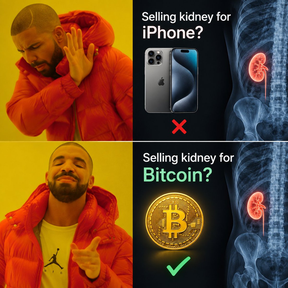 KunalAcharyaX's tweet photo. Selling a kidney for an iPhone? ❌
Selling a kidney for Bitcoin? Let's discuss 👀📈

Priorities change when you think long-term. 😂

 $BTC https://t.co/xpZrVa9C2N