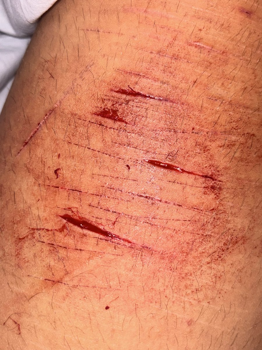 rir1_4bby's tweet photo. yesterday night i did some styros and they were bleeding like hell wtf is that normal? (SFX MAKE UP AI GENERATED!!) #shtwt https://t.co/EHERMP03qc