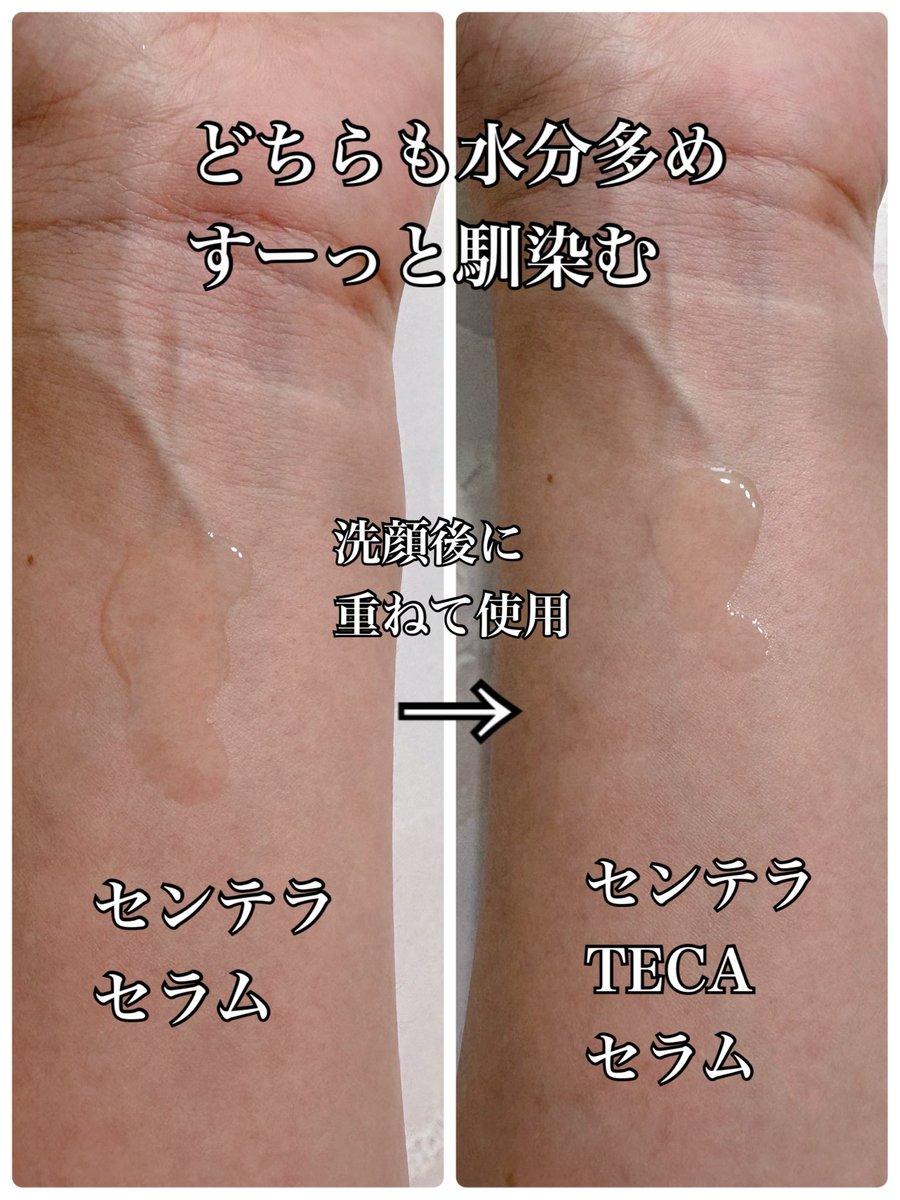 maple_and_child's tweet photo. SKIN1004さまからいただきました
#ガチモニター_SKIN1004
洗顔後すぐに2種を重ねて使う🧐
ゆらぎやすいお肌を落ち着かせて、バリア機能にもアプローチ！
トラブルのない健やか肌を目指したい👏
テクスチャーはどちらもサラサラ。
肌馴染みが良く、香りもなくて◎
美顔器と一緒に使うのもオススメ🫶🏻 https://t.co/uymVMy1z8O