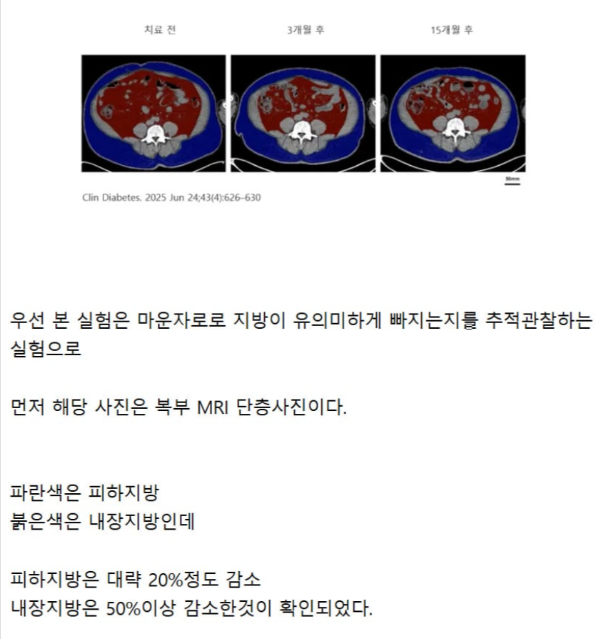 Dangerplanet's tweet photo. [정보] 마운자로를 맞고 살이 어떻게 빠지는지 추적관찰한 결과 https://t.co/WW64uORqMJ

예전에도 한 이야기지만 이건 진짜 안쓸 이유가 없는 약이라 공리적으로 엄청나게 이득인데 죽어라 틀어막는 이유를 알 수가 없다니까.

살인약은 열정적으로 풀어주고 싶고
가망없는 탈모약은 의보주고? https://t.co/uGZ6Dkg89c