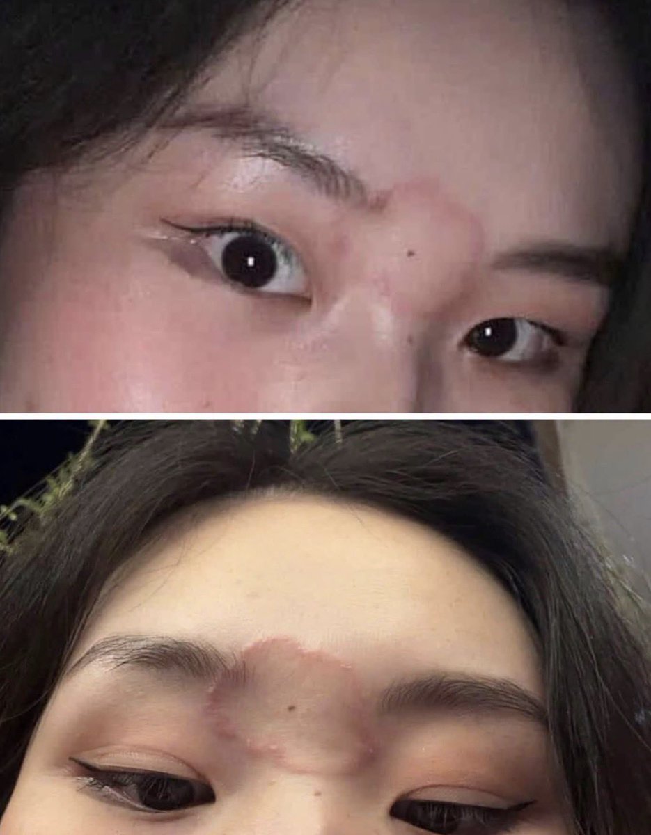 AzuraETH's tweet photo. Cuối tuần bạn mình đi date với ny tận 2 ngày, về nhà thì phát hiện ra cái này 🥺

Nhìn qua tưởng không có gì, nhưng càng nhìn càng thấy… có gì đó sai sai. Mọi người xem giúp với ạ?

Nó nghỉ làm nay rồi chỉ tâm sự với em thôi https://t.co/FGv4jLeKvr