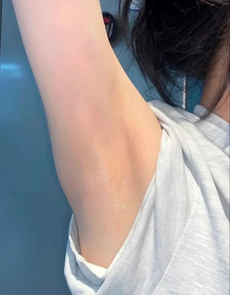 uniaorebeldebr2's tweet photo. SIAPAPUN YANG NEMUIN KOMBO INI, TOLONG SUNGKEM DULU🙏😭 Ga nyangka sama sekali bisa se-ngaruh ini buat nyerahin ketiak, beneran works parah sampe speechless 😭😭 https://t.co/CQiC4PX5Kf