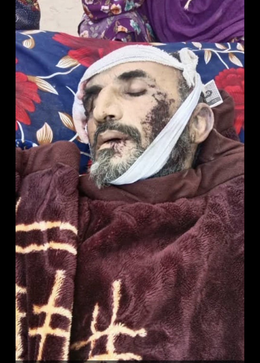 ahmadtaha02's tweet photo. نن د سپټمبر ۲۱مه د ملګرو ملتونو له خوا د «نړیوالې سولې ورځ “International Day of Peace “په توګه لمانځل کېږي. 🕊️
پاکستان په همدی ورځ دجنګ لاره غوره کړه او لاندی جنایت یی ترسره کړ . https://t.co/7FYjKzLtsU