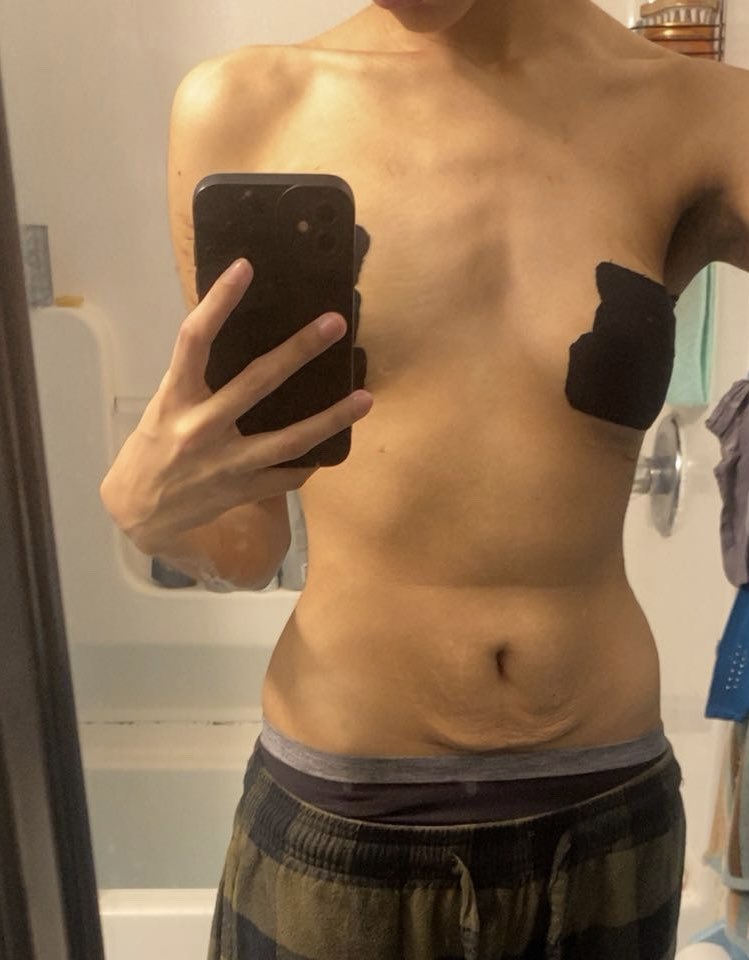 tylerssad_'s tweet photo. i need to get back to my prime i’ve ruined my body so much with every bite i take https://t.co/HACuSsjLm2
