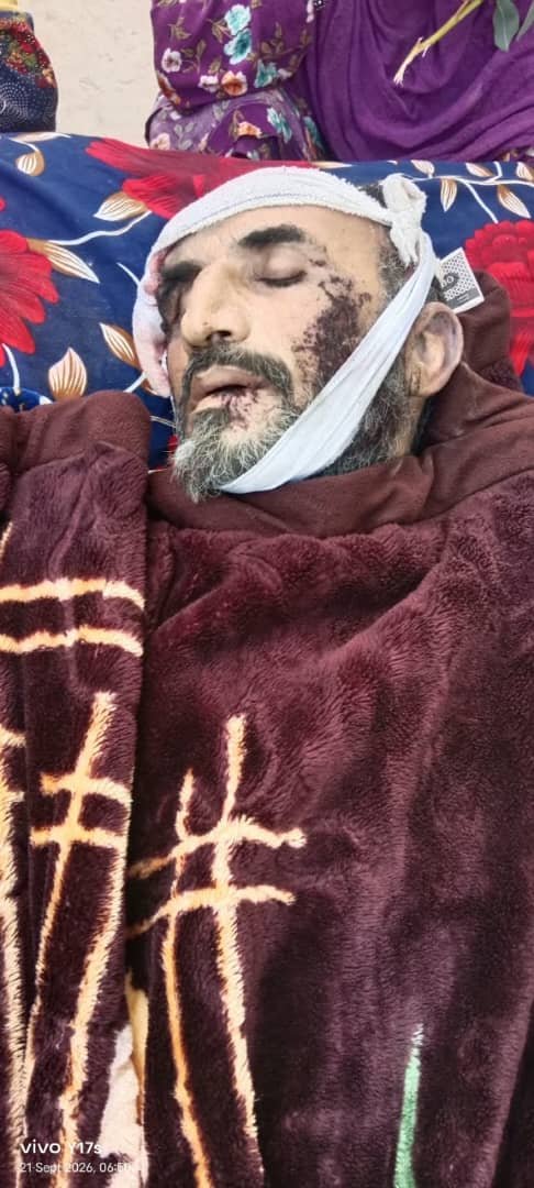 herawi61579's tweet photo. *کونړ کې د پاکستاني پوځي رژیم وحشت*

په نورګل ولسوالۍ کې په بیګاني ترسره شوي بمبار کې یو سړی او دوه تنه ښځې شهیدان او همداراز درې تنه سړي او یو تن ماشوم ټپیان شوي دي. https://t.co/Dpw0Vj5Kdp