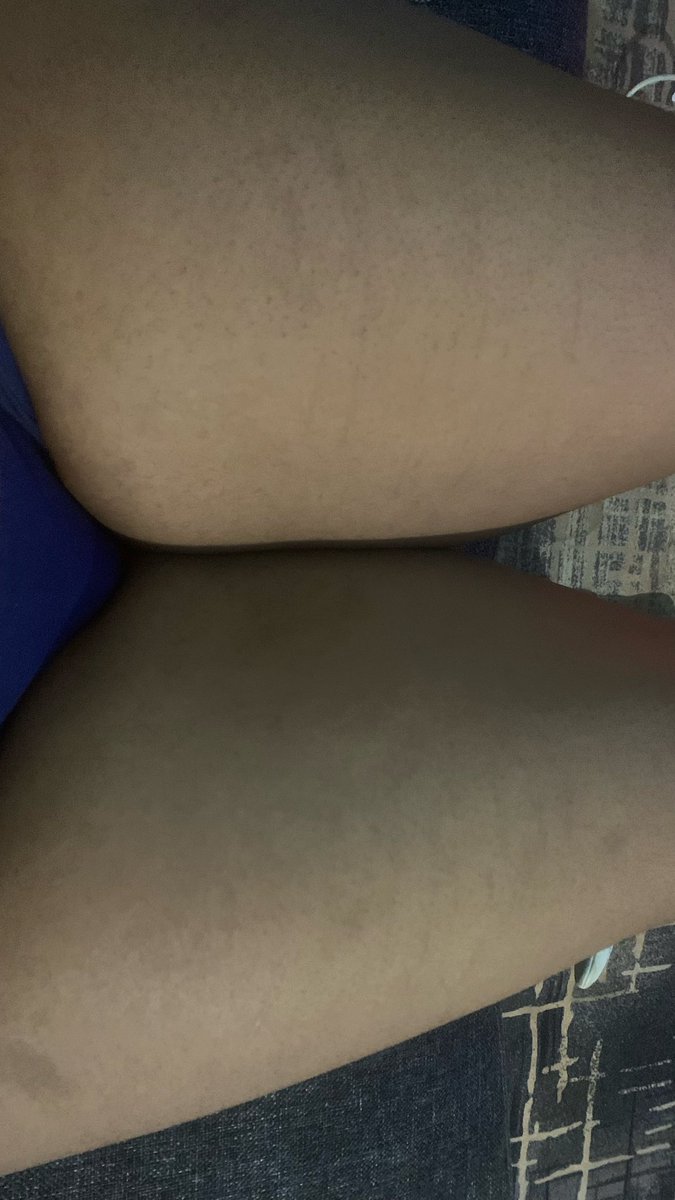 thighp1cs's tweet photo. Sit your head inbetween my thighs daddy #thighs #teen https://t.co/z8G1dGA8w5
