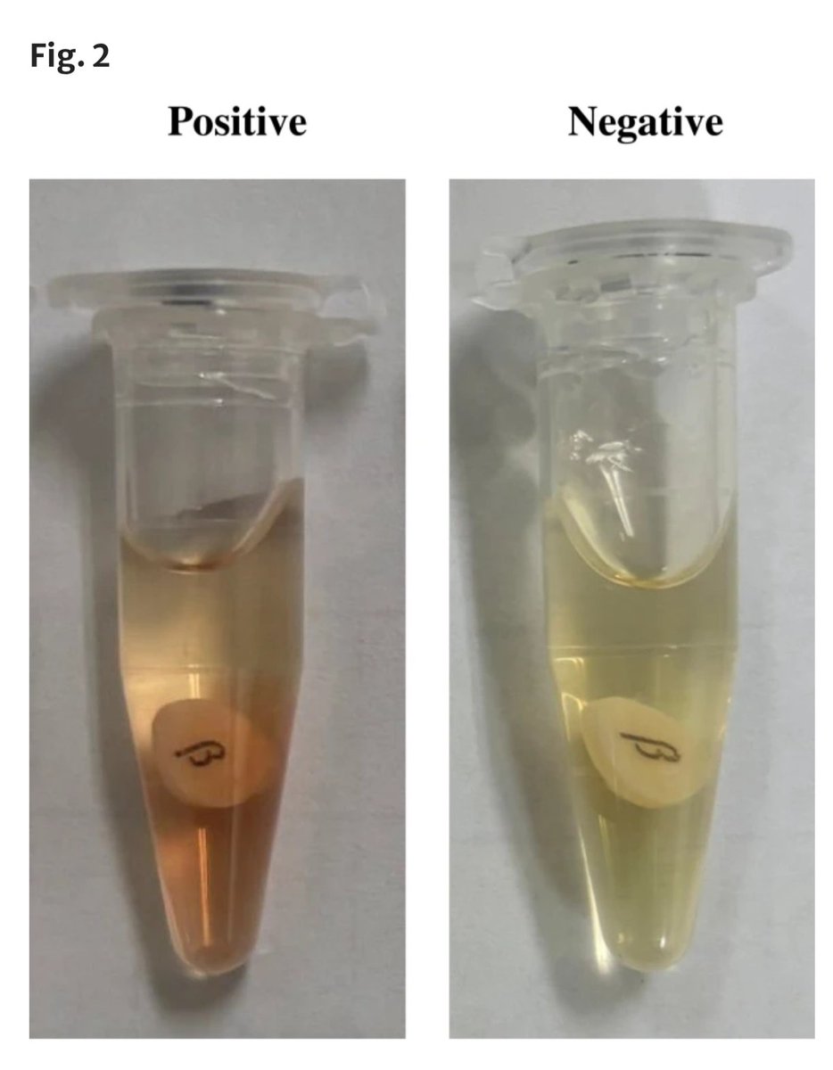 ABsteward's tweet photo. 🆕💥🟢 Development of a rapid diagnostic test for the cefazolin inoculum effect in methicillin-susceptible Staphylococcus aureus: Cefinase disk direct (CDD) test
The proposed CDD test demonstrated satisfactory diagnostic performance for the detection of blaZ type A-harboring MSSA isolates #idxposts
https://t.co/5WQJfGalsI