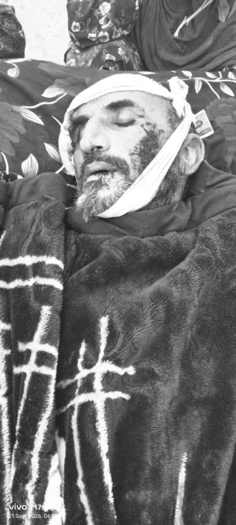 afghan_fact's tweet photo. فوجی رجیم کی جانب سے کیے گئے حملے کے متاثرہ شہری نور احمد کی تصویر۔ https://t.co/ZXRCSlfOrb