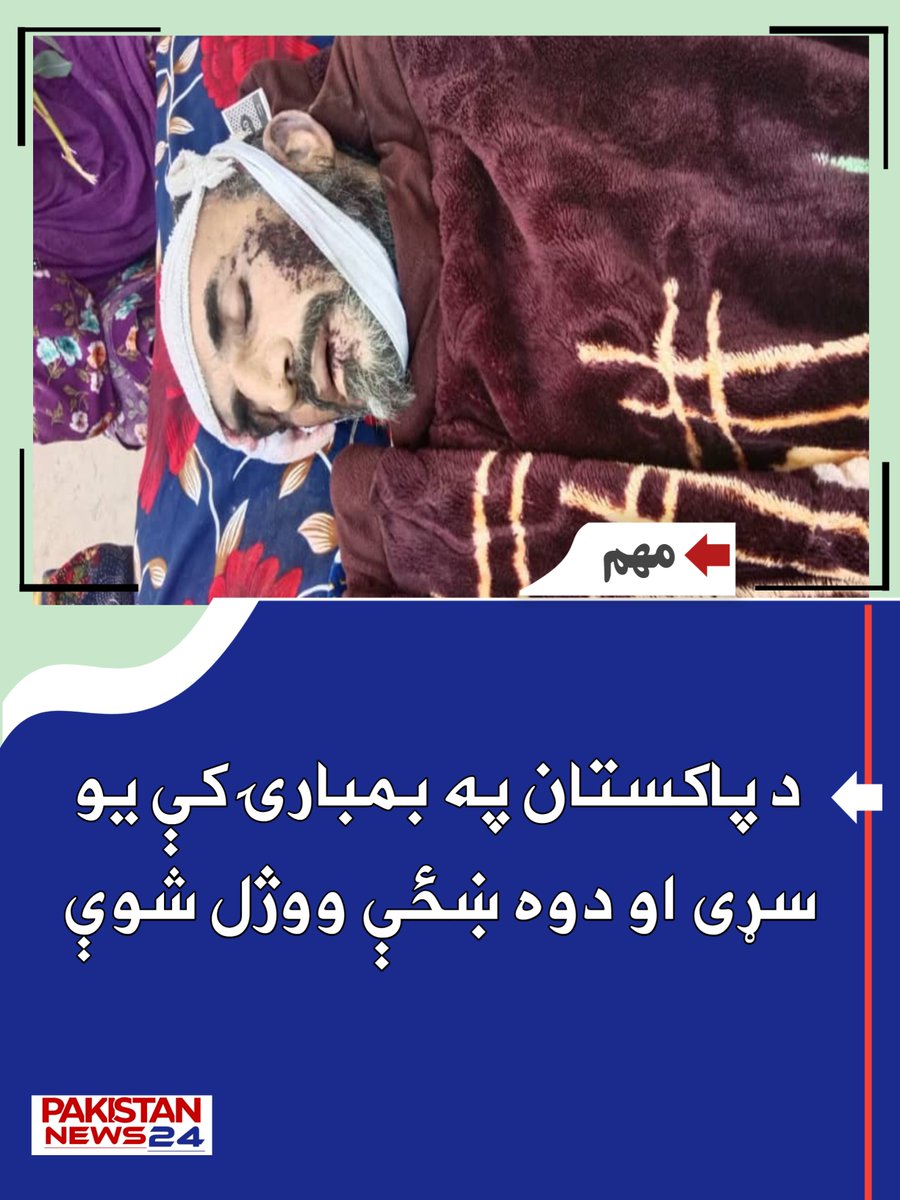 PakistanNews_24's tweet photo. #جنايت | #کونړ کې د پوځي رژیم وحشت!

د راپورونو له مخې، د کونړ د نورګل ولسوالۍ په اړوندو سیمو کې د تېرې شپې په ترسره شوي بمبار کې یو نارینه او دوه ښځې وژل شوي، او درې نارینه او یو ماشوم ټپیان شوي دي. https://t.co/FMsVRcsRrX