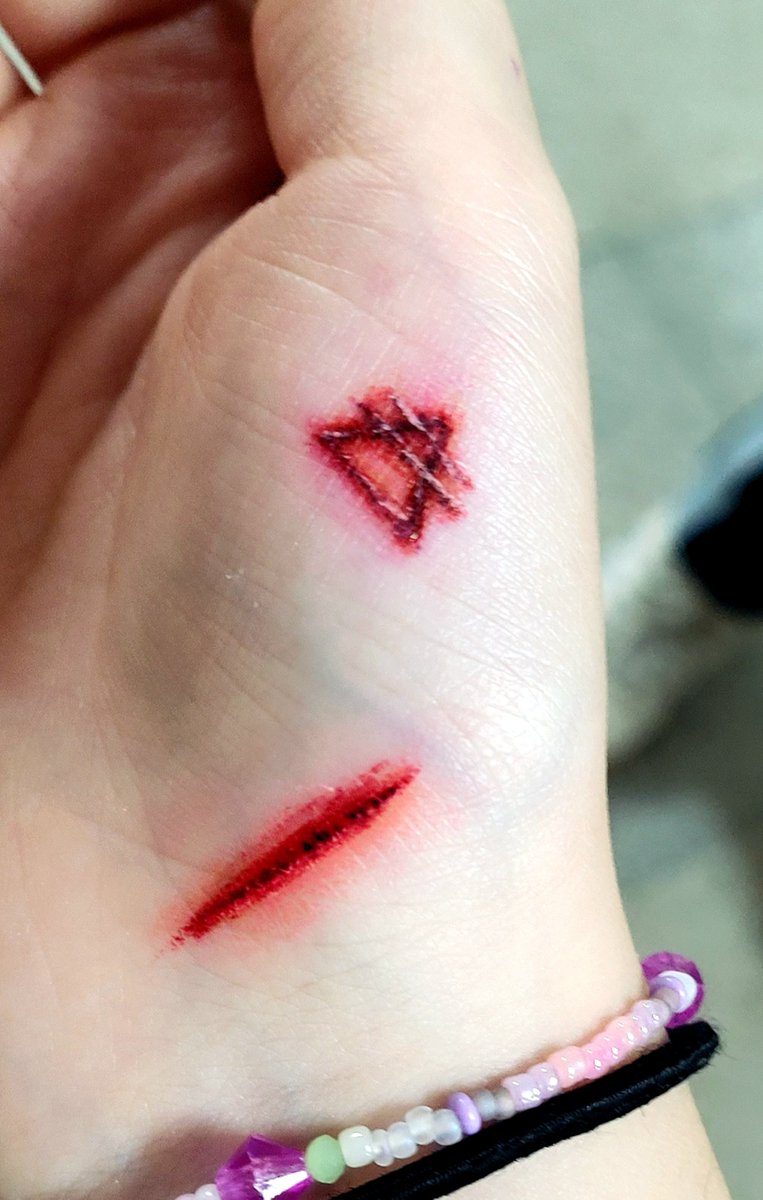 TIA110814's tweet photo. fake wounds!!!!!!!! https://t.co/Uvth6AFjKW