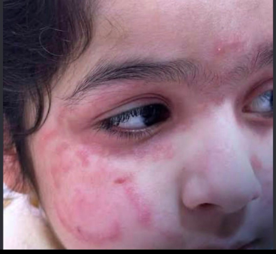 AlshanfariAmad's tweet photo. الانتشار العشوائي للمناحل في جبال #ظفار وأوديتها يجب أن يتوقف فقد أصبح مؤذيا للمقيم والسائح حان الوقت لوضع ضوابط واضحة تحدد مواقعها بعيدا عن التجمعات السكانية وأماكن التنزه بما يحفظ سلامة الناس وراحتهم وينظم هذه المهنة ويحمي مصالح أصحابها. #صلالة @MAFWR_OM #سلطنة_عمان  #مسقط https://t.co/HnClI559r9
