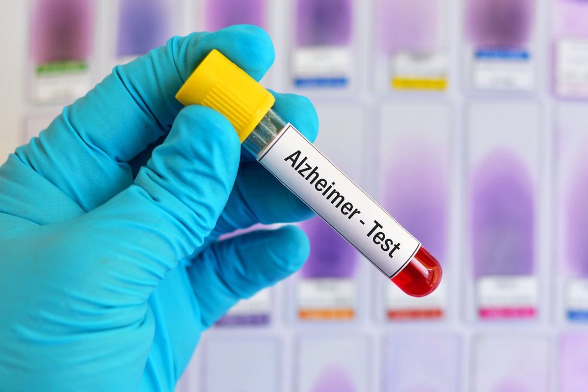 Balance_web's tweet photo. #REPORTAJE | La investigación del #alzhéimer abre nuevas vías para adelantarse a la enfermedad

📌Hoy os compartimos un reportaje sobre ✍️ algunas de las líneas de investigación que están abriendo nuevas vías para adelantarse a la enfermedad y comprender mejor su evolución. https://t.co/gLlWxXfGiw