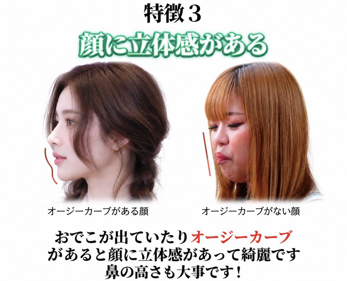 mtgjdpa's tweet photo. 爆美女の条件4選、保存版！！！

①ペットボトルより小顔
両顎手術➕オトガイ形成でも短縮できて1cmちょっとなだけに1番あると有利な特徴

②中顔面が短い
童顔ロリたぬき顔の大ブームによって中顔面の短さが重要視されている。ミッドフェイスリフトで頬の位置を高くする。

③顔の立体感がある
出鼻と奥鼻、OGカーブの有無が格差を生む。鼻フル＋頬骨セットバックの出番。

④鼻の下が短い
指一本分よりも短いかどうかが別れ目になる。人中縮小か鼻中隔延長で短く見せる？