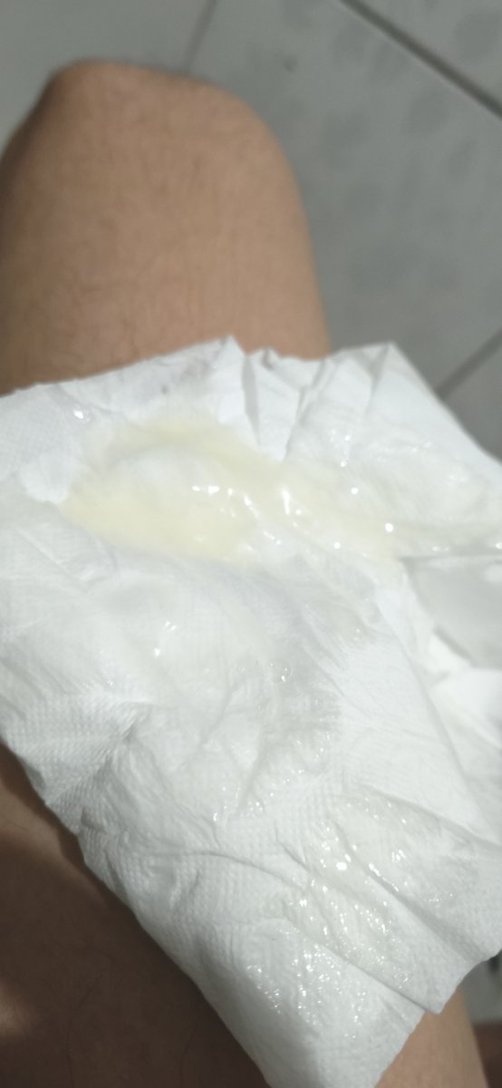 lee_ray_60's tweet photo. Con mucha fiebre en estos últimos días https://t.co/5PBWmqAzeN