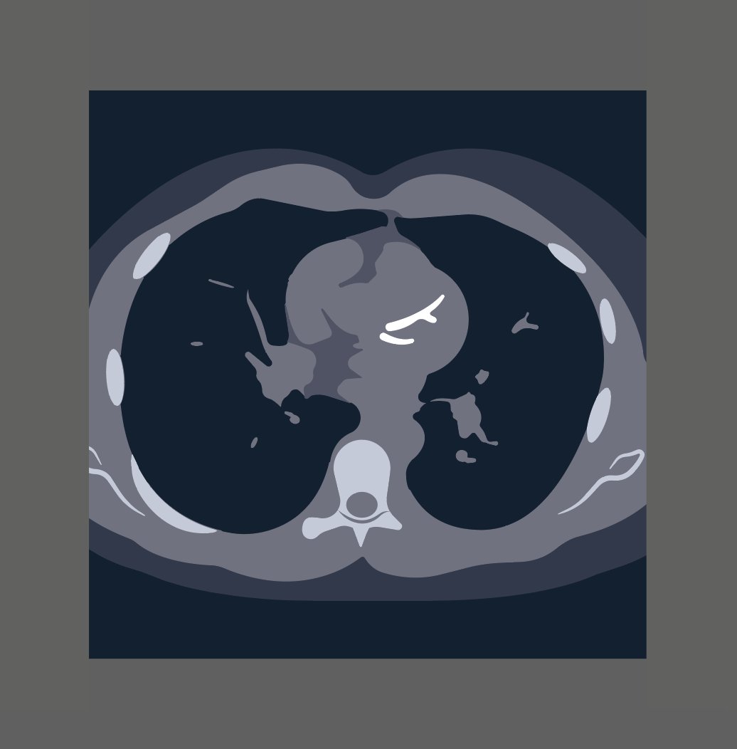 contextflow_rad's tweet photo. 🫁 Just in time for fall, our #LCS solution now also flags incidental coronary artery calcification (iCAC)!

One CT scan, two clinically relevant findings — nodules and cardiovascular risk — evaluated in the same workflow you already use.

Talk to us https://t.co/8y4mtdQQuN https://t.co/Ze3Ov8LSsv