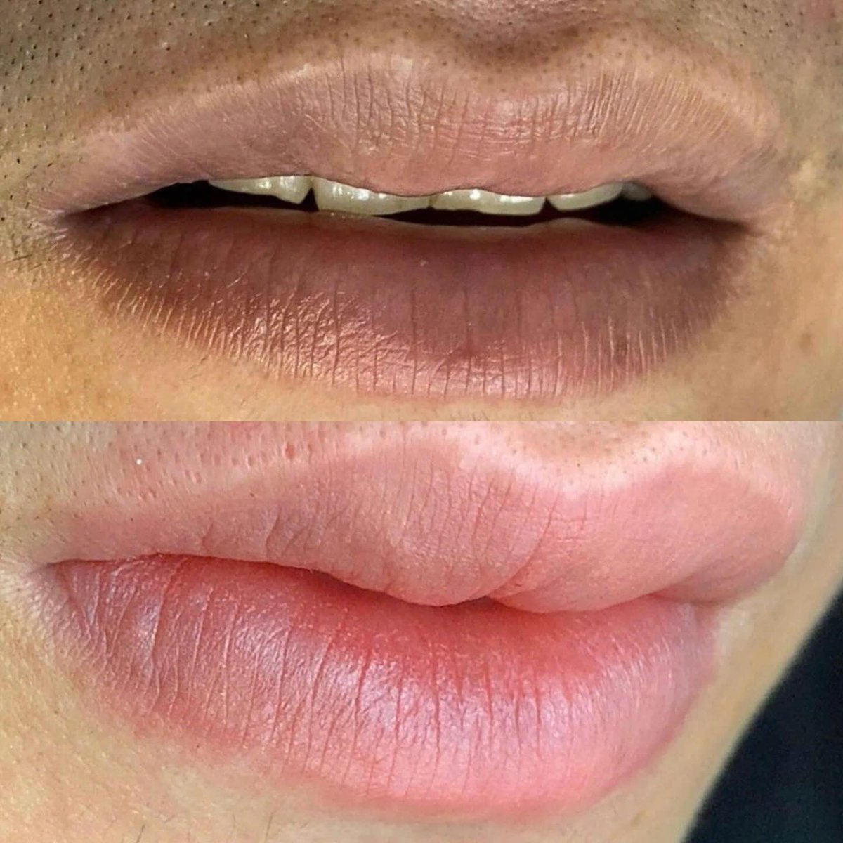 evertomsr's tweet photo. MICROBLADING – NATURAL, REAL-LOOKING EYEBROW SCULPTING
Are you tired of having to trim and draw your eyebrows every morning but they are still uneven? Let Microblading help you have sharp, natural eyebrows that are balanced with your face without https://t.co/0LKs2GWWZn
