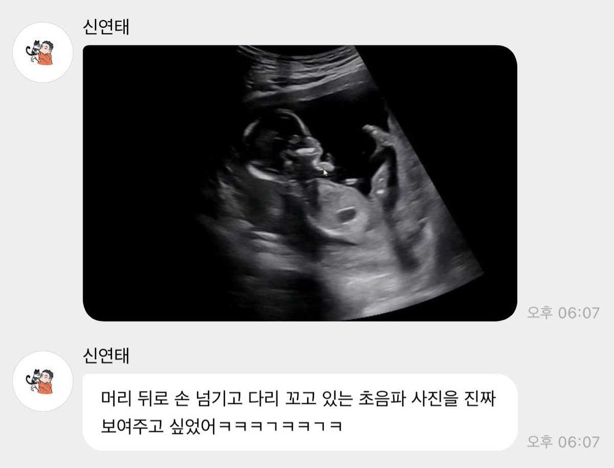 nerd_0juicy's tweet photo. 너무너무 소중하여라 … 😭😭
무럭무럭 자라서 건강하게 태어나렴 찰떡아 😄🫰 https://t.co/M3WiQ12iBP