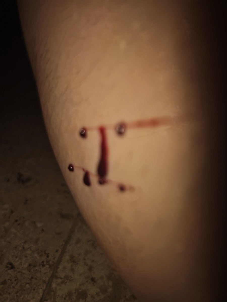 itsFishwithgues's tweet photo. More cat scratches and a bit of multiswiping form the beginning 

And forgive the trembling in the second video, I just had way too many monsters today
ALL FAKE SFX MAKEUP PRACTICE 

#shtwt #sh https://t.co/Wc5ZU8Z3Yi