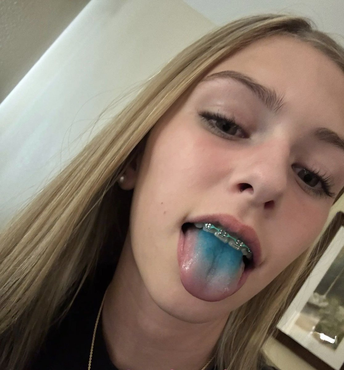 JohnSmithr75h7's tweet photo. If all you need are braces to get triggered then you are a pervert

#nsfwtwt #goon #braces #perv https://t.co/MBQRLKIYBt
