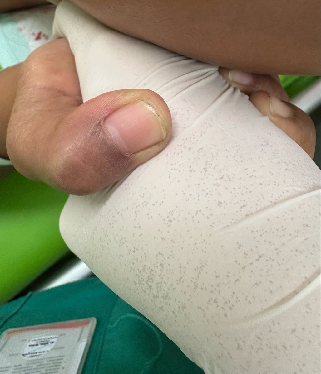 skyi71h's tweet photo. day one obgyn lgsg dapet partus cuy😌 luar biasa mantap. review: kaget bgt jujur karena lahiran spontan kayak gitu ya.. terus juga secepat itu?!?!? damnn. amazing perjuangan seorang ibu😔🫶🏼

ini si ibu memegang tangan ku dengan erat wkwkwkw https://t.co/cu61Jw9yi3