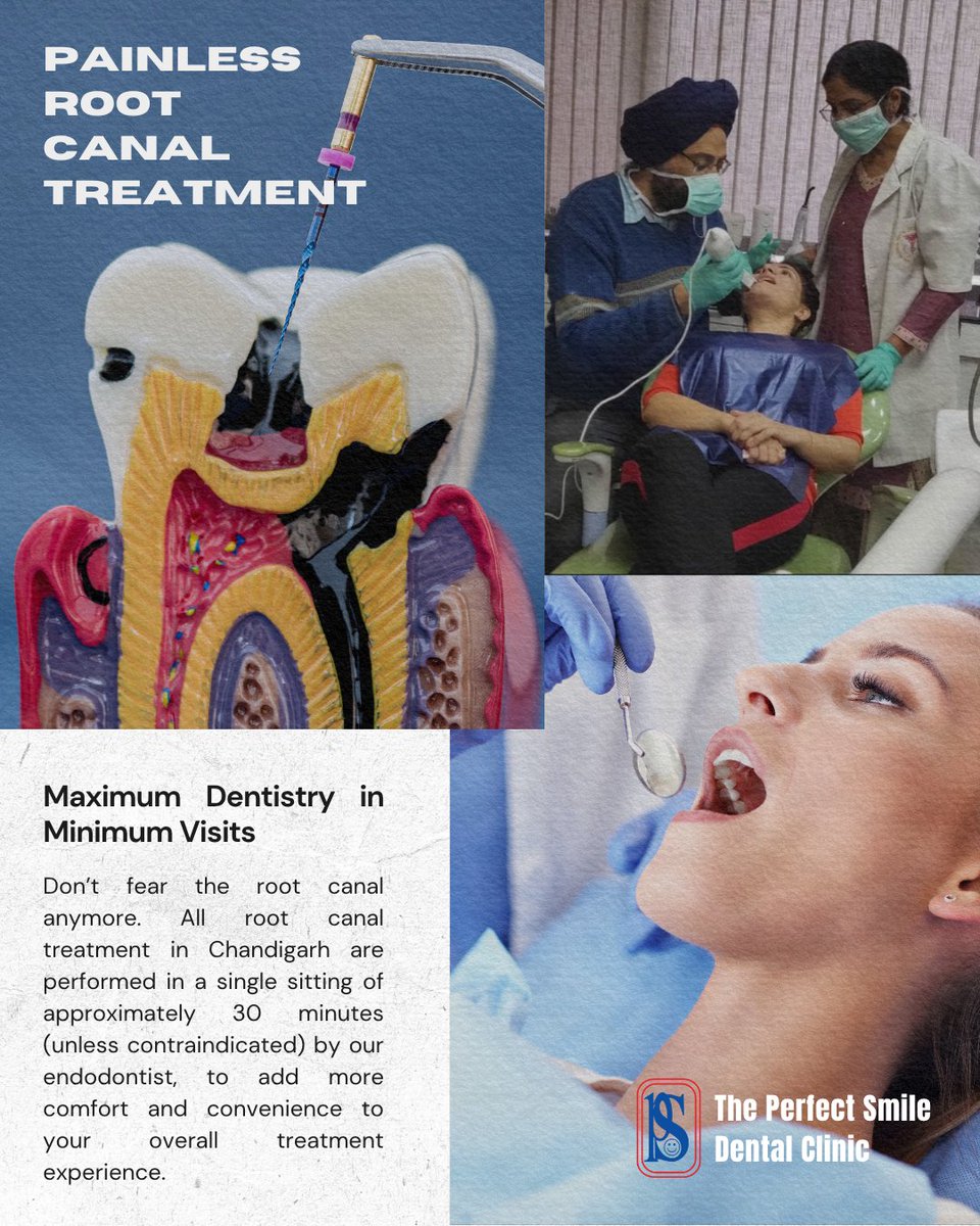 perfectsmile35's tweet photo. 🦷 Worried about a root canal? It doesn't have to be scary. At The Perfect Smile Dental Clinic, we focus on comfortable, painless root canal treatment to help save your natural tooth. Book your consultation today! 
📍 Sector 35-C, Chandigarh
 
#RootCanal #DentistInChandigarh https://t.co/YNjnA62Vfl