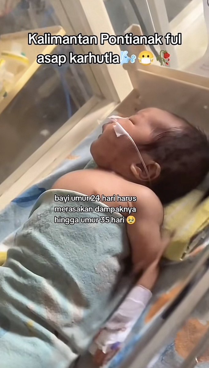 komisarisnetzen's tweet photo. Udah ada di tahap:
"Yuk makin semangat lagi pemerintah, kalian pasti bisa" 

Puluhan ribu anak dari bayi sampai balita mengalami ISPA akibat karhutla dan jumlahnya makin bertambah.

YA ALLAH SELAMATKAN ANAK-ANAK KECIL INI😭 https://t.co/YkneRQrDfn