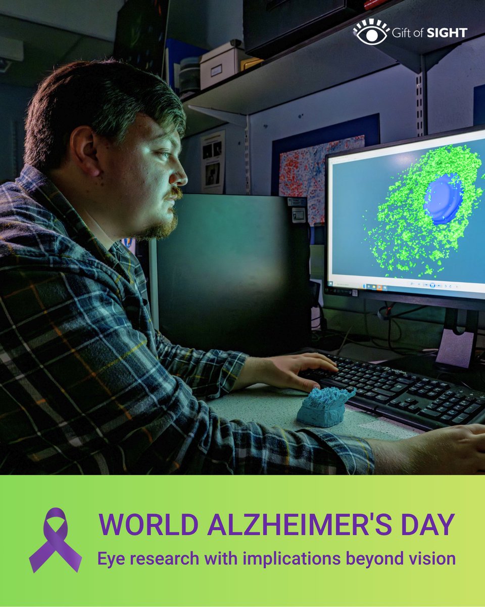 giftofsight1's tweet photo. #EyeResearch can help unlock insights beyond vision. This #WorldAlzheimersDay we're highlighting the work of Charlie Ellis, whose @unisouthampton research into lysosomes is helping us better understand #AMD and other age-related diseases like #Alzheimers and #Parkinsons. https://t.co/CgFlDkEsv5