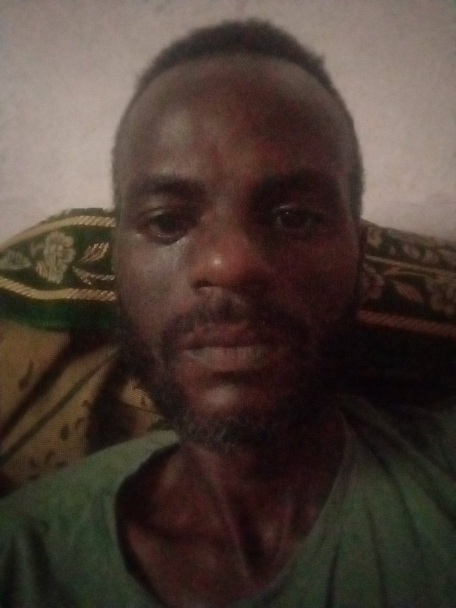 an_jmy40244's tweet photo. A black Palestinian man who doesn't want to starve, black Palestinians are forgotten
https://t.co/4U9xyx6jtA https://t.co/DEVgXwjWtr
