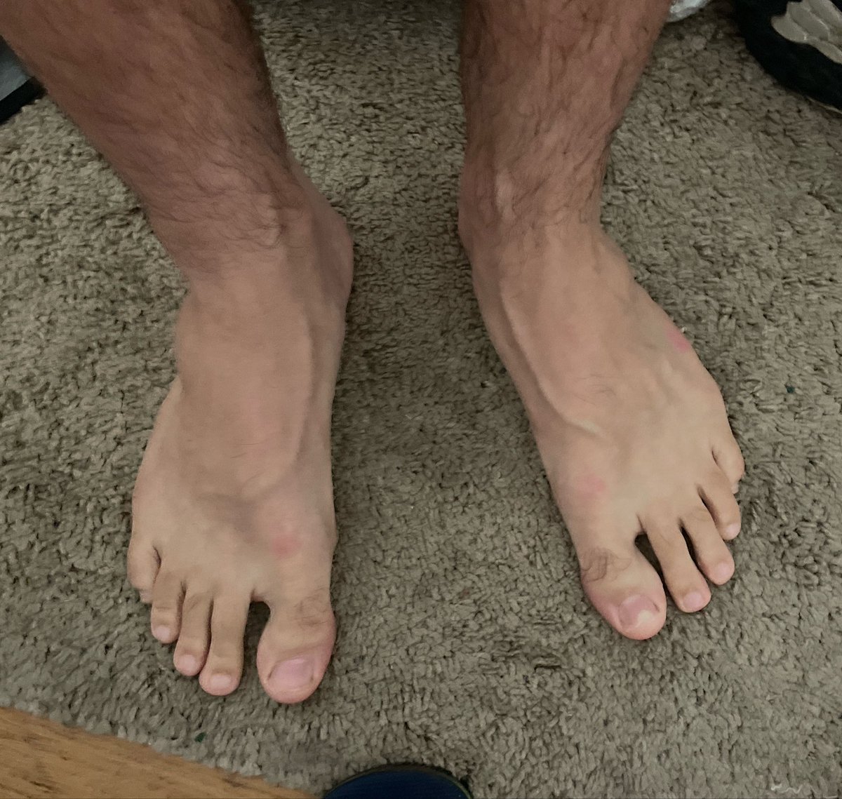 MikelHot112's tweet photo. Mis pies 🥵🥵😝😝🔥 https://t.co/OWVpdWFO15