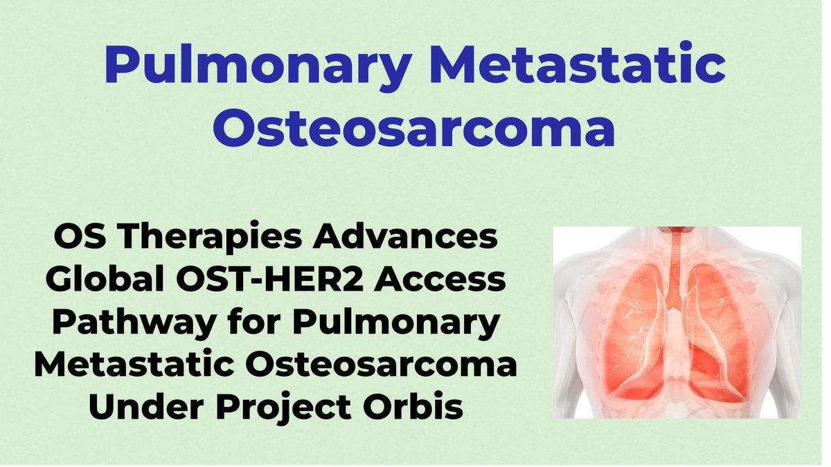 CheckOrphan's tweet photo. OS Therapies Advances Global OST-HER2 Access Pathway for Pulmonary Metastatic Osteosarcoma Under Project Orbis - For More Information Visit  https://t.co/pGYbERENlc  @OSTherapies  #rare_Diseases  #Bone_Cancer  #Pulmonary_Metastatic_Osteosarcoma  #Orphan_Drugs  #OS_Therapies https://t.co/iNj7jPt6I3